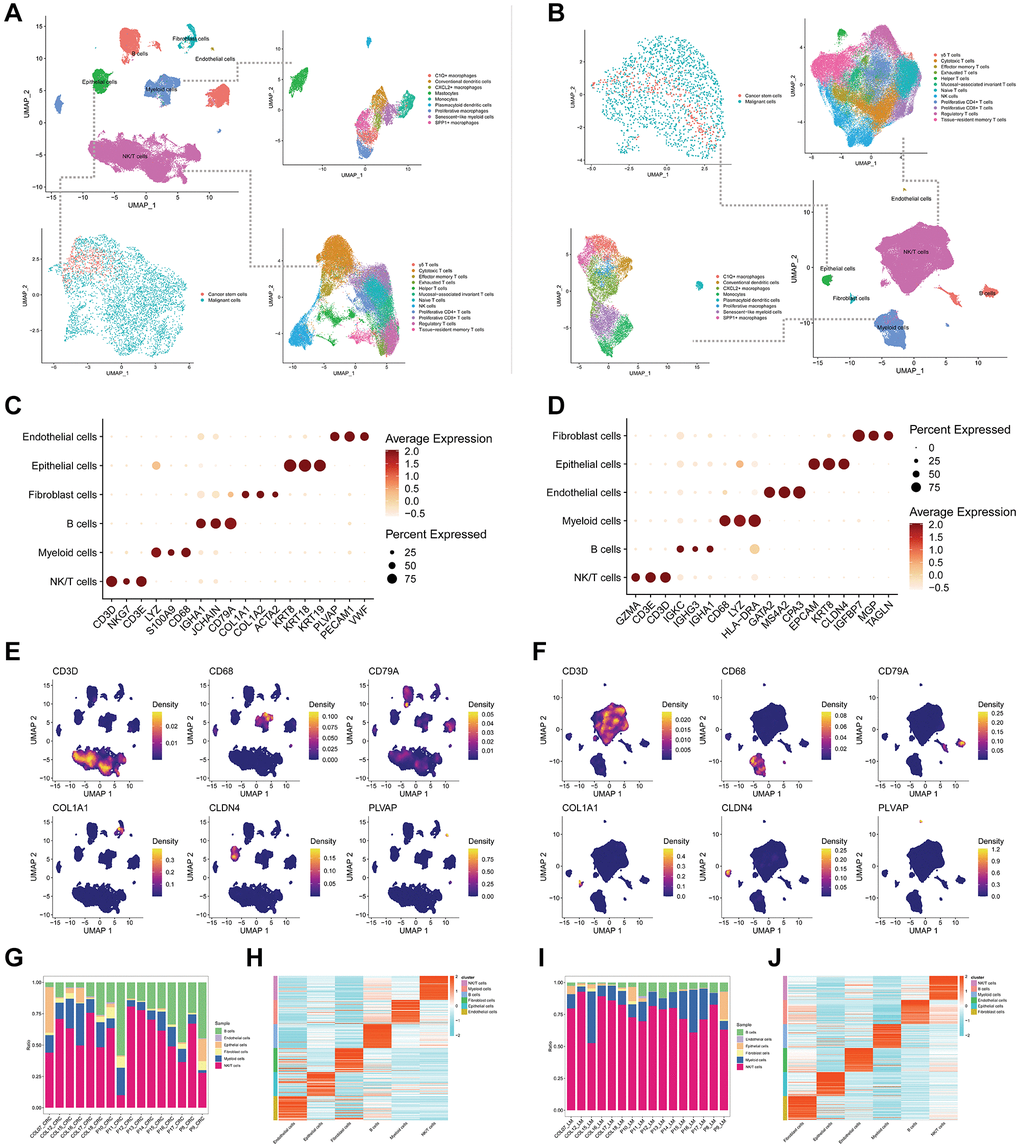 Cell annotations and features of colorectal cancer tissues from primary and liver metastasis. (A, B) UMAP-based dimensionality reduction clustering plots depict the annotation results of main cell types in primary (A) and liver metastasis (B) colorectal cancer tissues, along with further subannotations for epithelial cells, myeloid cells, and NK/T cells. (C, D) Bubble plots illustrate the expression levels of the top 3 markers in main cell types of primary (C) and liver metastasis (D) colorectal cancer tissues. (E, F) UMAP-based dimensionality reduction is employed to illustrate the density features of the top 1 marker in main cell types of primary (E) and liver metastasis (F) colorectal cancer tissues. (G) A proportion plot displays the distribution of primary cell types across 16 different primary colorectal cancer tissues. (H) A heatmap presents the expression levels of the top 50 differentially expressed genes in the main cell types of primary colorectal cancer tissues. (I) A proportion plot depicts the distribution of main cell types in 16 different liver metastasis colorectal cancer tissues. (J) A heatmap displays the expression levels of the top 50 differentially expressed genes in the main cell types of liver metastasis colorectal cancer tissues.