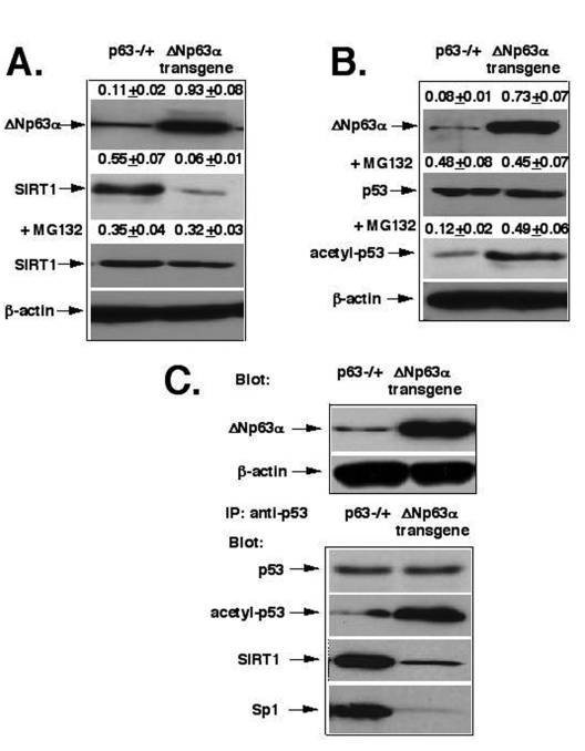 ΔNp63α mediates the SIRT1 degradation and p53 deacetylation