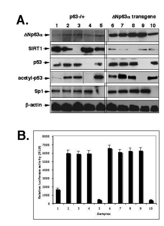 ShRNA silencing of ΔNp63-SIRT1-p53-Sp1 pathway
