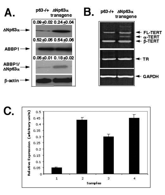 ΔNp63α increases levels of the mTERT-spliced isoforms via protein interaction with ABBP1