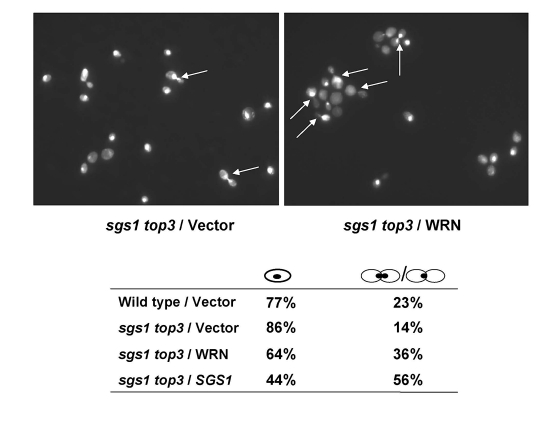 WRN expression induces S/G2 arrest in sgs1 top3 cells