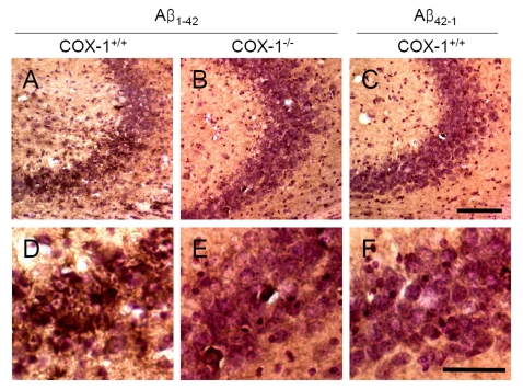Increased oxidative damage in the hippocampus 7 d after Aβ 1-42 administration