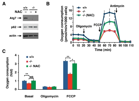 NAC treatment partially corrects the metabolic defect observed in Atg7 -/- MEFs
