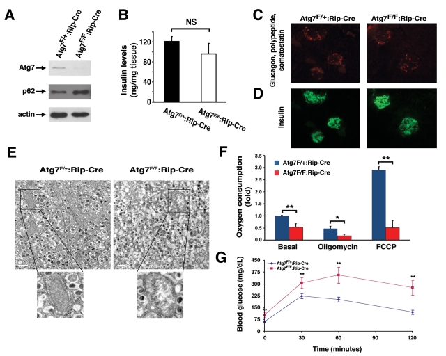Mice deficient in Atg7 expression within pancreatic β cells demonstrate altered mitochondria