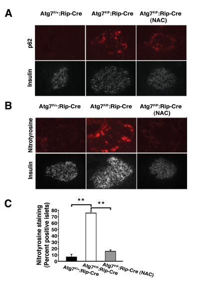 In vivo treatment with NAC reduces oxidative stress within pancreatic β cells