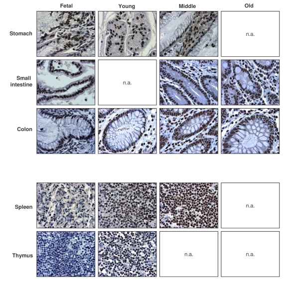 Immunohistochemical detection of AUF1 across tissue types and age groups