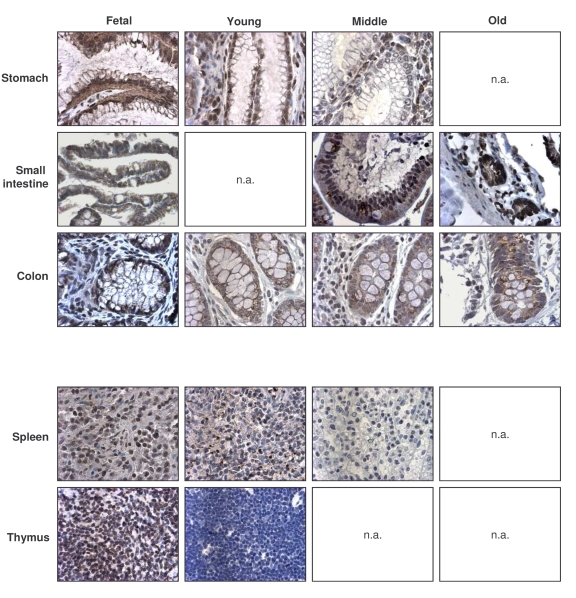 Immunohistochemical detection of TTP across tissue types and age groups