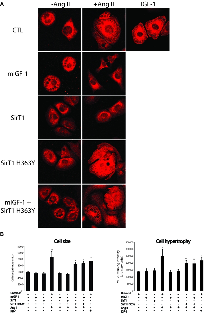 mIGF-1 prevents Ang II- and IGF-1-induced cell hypertrophy (MF-20 staining) in HL-1 cardiomyocytes