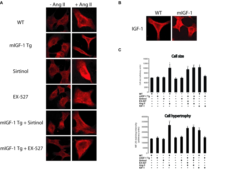 mIGF-1 prevents Ang II- and IGF-1-induced cell hypertrophy (MF-20 staining) in mouse neonatal primary cardiomyocytes