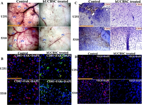 Inhibition of in vivo angiogenesis by hUCBSC