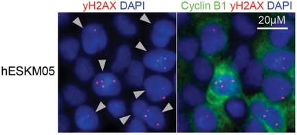 Double immunofluorescence staining of hESCs with γ-H2AX (red) and G2-specific Cyclin B1 (green) antibodies revealed high frequency of γ-H2AX foci in cells at G2 phase