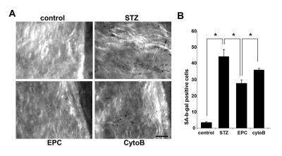 Senescence-associated β-galactosidase stained endothelial cells in en face aortic preparations obtained from control and STZ mice, non-treated or treated with intact EPC or with EPC preincubated with cytochalasin B (CytoB)