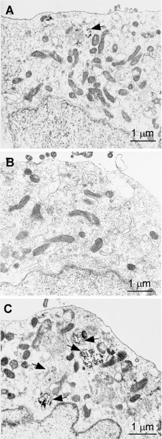 Transmission electron microscopy of cells expressing PrPWt, PrPT183A, or PrPF198S