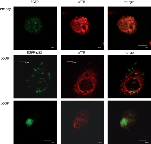 Different localisation of p53 isoforms after rotenone treatment. p53−/− HCT116 cells transfected with empty EGFP pCMS plasmid (upper panels), EGFP-p53R72 pCMS plasmid (central panels), or EGFP-p53P72 pCMS plasmid (lower panels) and counterstained with MitoTracker Red (MTR). Cells transfected with the empty vector show a diffused EGFP fluorescence, not associated with any cell structure; in cells transfected with the plasmids expressing the p53 isoforms, a different subcellular localisation is noticed, as assessed by counter-staining with the mitochondrial-specific probe MTR. In particular, when EGFP-p53R72 pCMS plasmid is used, EGFP fluorescence, associated to p53 protein, appears to be not nuclear but rather co-localised with MTR fluorescence, indicating that p53 has a mitochondrial localisation (white dots indicate points of overlapping of the two fluorescences).