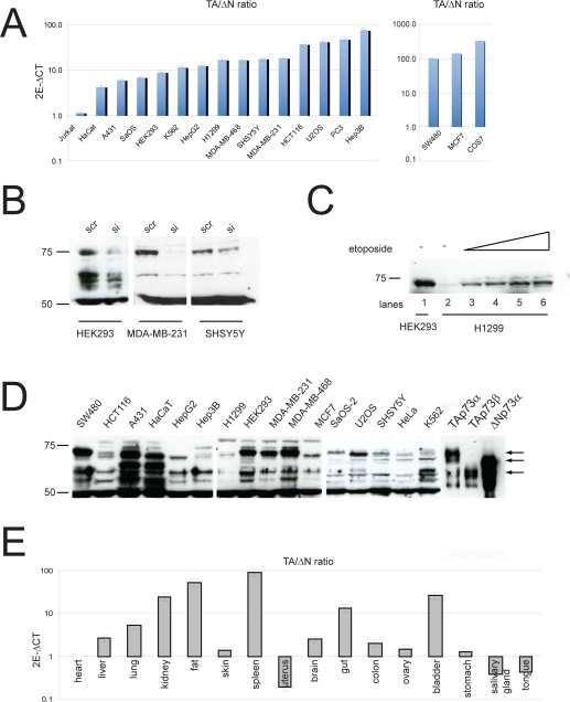 Expression of p73 isoforms