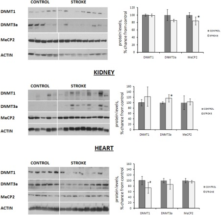 Expression of DNA methyltransferases and methyl-binding protein MeCP2 in liver, heart and kidney tissues of control and stroked rats