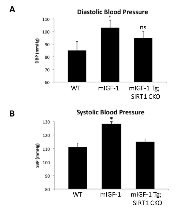 Blood pressure in WT, mIGF-1 Tg and mIGF-1 Tg; SIRT1 CKO mice