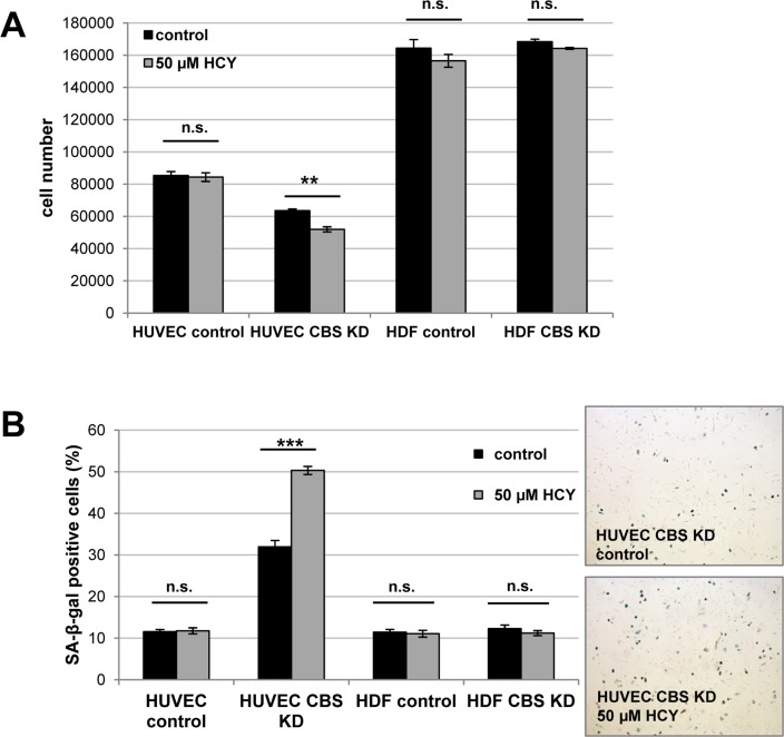 CBS depletion increases susceptibility of HUVEC to homocysteine-induced senescence