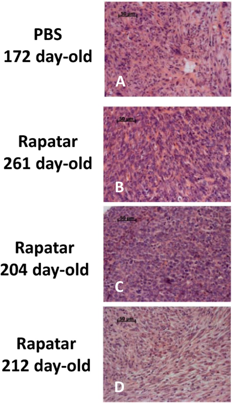 Rapatar delays development of sarcomas in p53−/− mice. (A) Liver sarcoma in 172-old control mouse. (B,C) Sarcoma developed in 261 day- and 204 day-old Rapatar-treated mice. No metastases are detected. D. Sarcoma in 212-day old Rapatar-treated mouse with metastases in the lung.