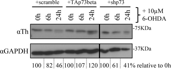 p73 counteracts depletion of Th by 6-OHDA