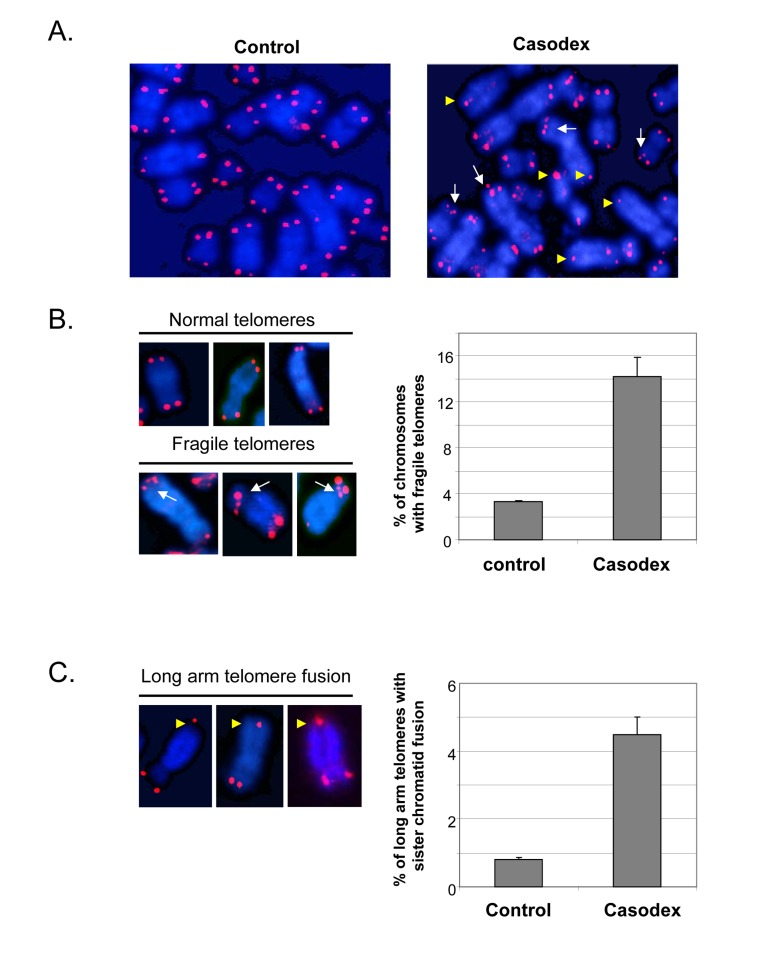 Casodex treatment causes fragile telomeres and sister chromatid fusion in LNCaP cells