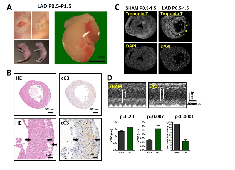 Complete cardiac regeneration in a mouse model of myocardial infarction