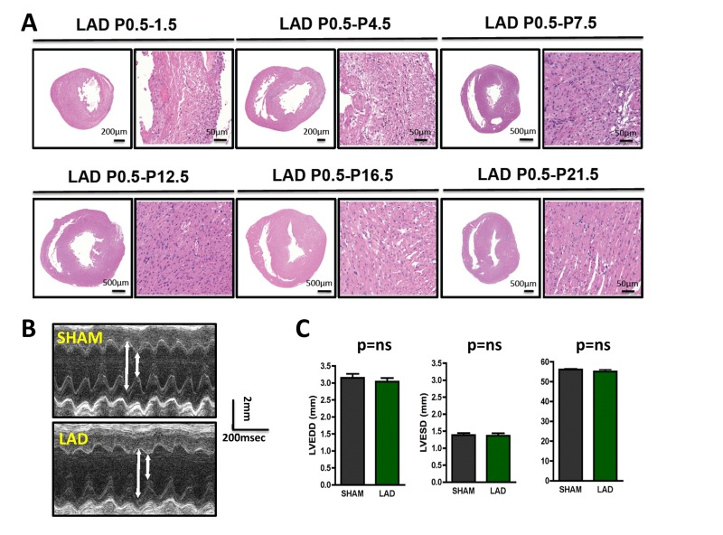 Complete cardiac regeneration in a mouse model of myocardial infarction