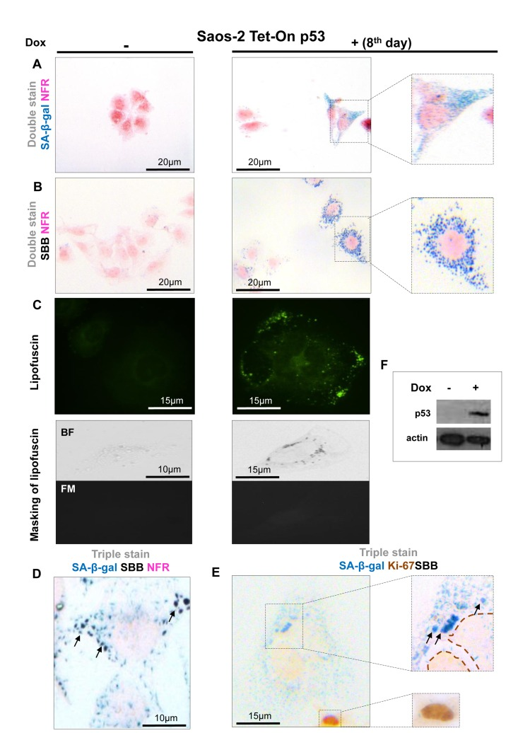 Specific Lipofuscin Staining As A Novel Biomarker To Detect Replicative ...