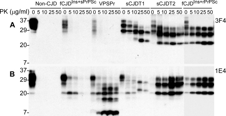 Determination of PK-resistant PrPSc with the 1E4 antibody. A: Brain homogenates from non-CJD, fCJDIns+sPrPSc (case 6), VPSPr with 129VV, sCJD type 1, sCJD type 2, and fCJDIns+rPrPSc were treated with a variety of concentrations of PK prior to SDS-PAGE and Western blotting with 3F4. PK-resistant PrP was only detected in sCJD type 1, type 2, or fCJDIns+rPrP but not in other cases. B: The PK-treated PrP from these cases were detected with 1E4. In contrast, PK-resistant PrP was also detected in both fCJDIns+sPrPSc and VPSPr, in addition to sCJD type 1, type 2, and fCJDIns+rPrPSc. However, the PK-resistant PrP in fCJDIns+sPrPSc was only detected when treated with lower amounts of PK less than 25 μg/ml.