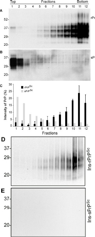 Comparison of oligomeric state of PrP in case 6 and other cases with rPrPSc by sucrose step gradient sedimentation. (A) Western blotting of PrP in individual fractions of sucrose gradient analysis of brain homogenate from case 3 with readily detectable rPrPSc. (B) Western blotting of PrP in individual fractions of sucrose gradient analysis of brain homogenate from case 6 with sPrPSc. C: Bar graph of PrP in individual fractions from three 144-bp insertion mutation cases with rPrPSc (average of PrP percentages from the three fCJDIns+rPrPSc cases) and case 6 with no rPrPSc. Blots were probed with 3F4 antibodies. D and E: PrP in individual fractions from cases 3 (D) and 6 (E) was detected by Western blotting after treatment with PK at 0.5 μg/ml. PrP was only detected in fCJDIns+rPrPSc but not in fCJDIns+sPrPSc.