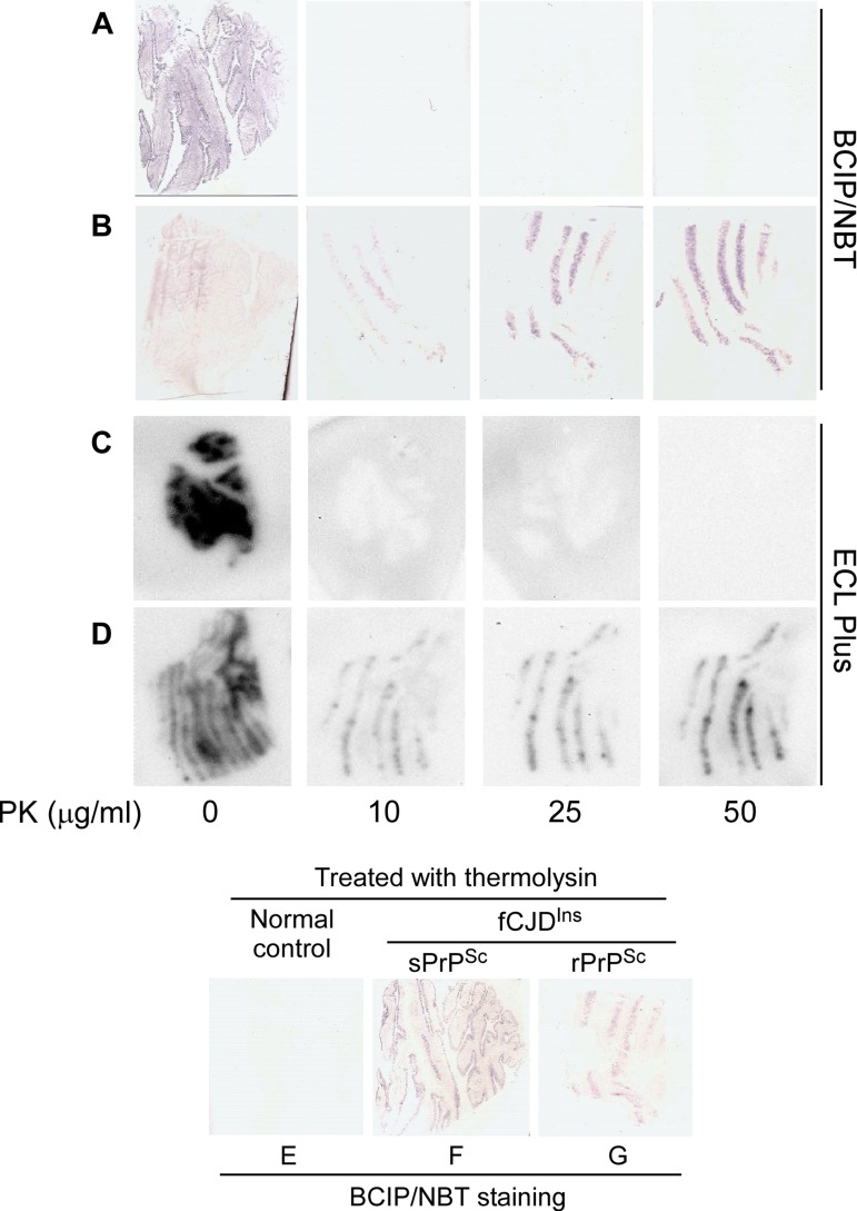 Histoblotting of fCJDIns+sPrPSc and fCJDIns+rPrPSc. The nitrocellulose membranes blotted with tissue sections from the cerebellar cortex of fCJDIns+sPrPSc (A, C, and F) or fCJDIns+rPrPSc (B, D, and G) were developed with BCIP/NBT similar to classic IHC in A, B, E, F, and G while the membranes were developed with ECL Plus similar to Western blotting in C and D. PrP staining was detected in all blots without PK-treatment. After PK-treatment at either 10, 25, or 50 μg/ml, no PrP staining was detected in the samples from fCJDIns+sPrPSc (A and C), whereas PrP was detected in the samples from fCJDIns+rPrP (B and D). In contrast, PrP staining was detected in fCJDIns+sPrPSc (F) in addition to fCJDIns+rPrP (G) but not in normal controls after thermolysin that was reported to digest PrPC only (E).
