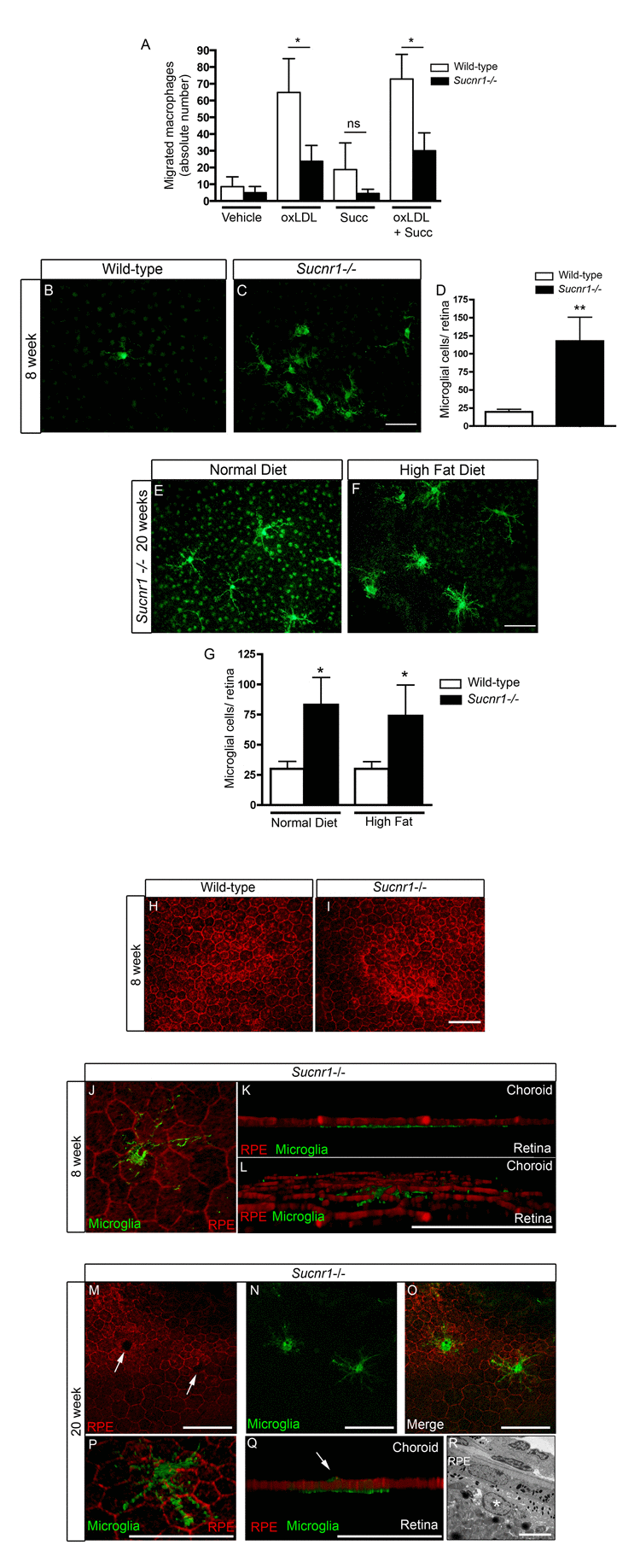 SUCNR1 deficient microglia show impaired migration and accumulate in the subretinal space