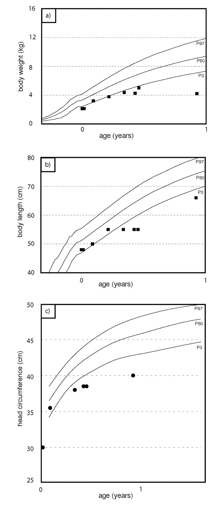Weight percentiles (a), growth percentiles (b), head circumference percentiles (c) during the course of the disease. At birth, the patient was small for gestational age. Weight gain stagnates at about two months of age. Length and head circumference growth rank below 3rd percentile.