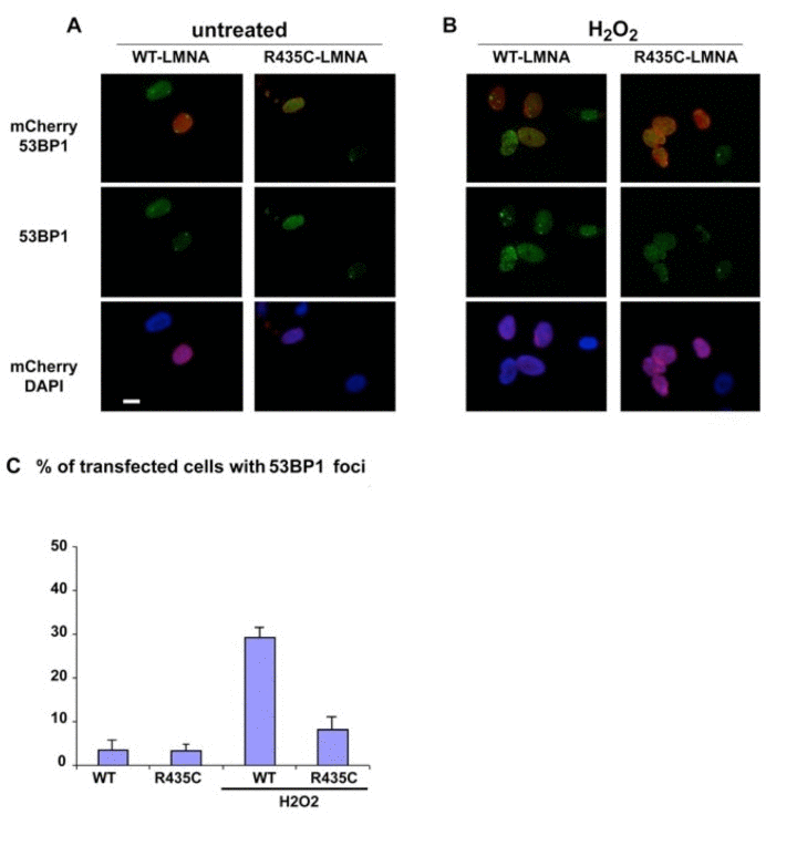 53BP1 localization in cultured human normal fibroblasts transfected with either mCherry-tagged LMNA-p.R435C or mCherry-tagged wt- LMNA plasmids. (A) untreated or (B) treated with hydrogen peroxide (H2O2). 53BP1 was specifically labeled using a monoclonal antibody and revealed by FITC –conjugated anti-mouse IgG secondary antibody (green). (C) Quantitation of 53BP1 foci in H2O2 –treated cells. Means of three different counts performed in separate experiments are reported +/− standard deviation. The difference is statistically significant (p