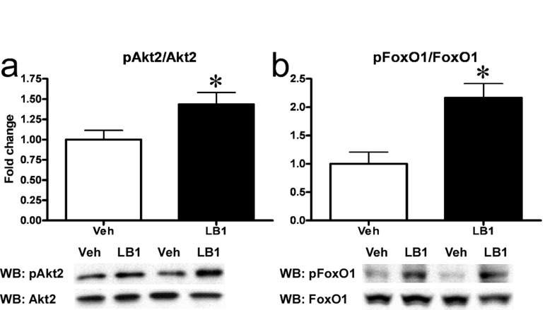 PP2A inhibition acutely improves hepatic insulin signaling in fat-fed rats. I.p.-injection of LB1 resulted in an augmented insulin-stimulated phosphorylation (Ser474) and activation of hepatic Akt2 (Ser474) (a) and phosphorylation (Ser256) and inactivation of FoxO1 (b)in vivo. Fold change is relative to insulin-stimulated, vehicle-injected rats. Data are averages of western blot quantifications ±SEM. * P