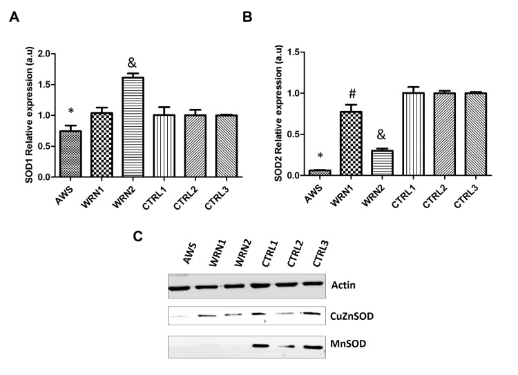 Analysis of the superoxide detoxifying enzymes in atypical Werner syndrome and Werner syndrome fibroblasts