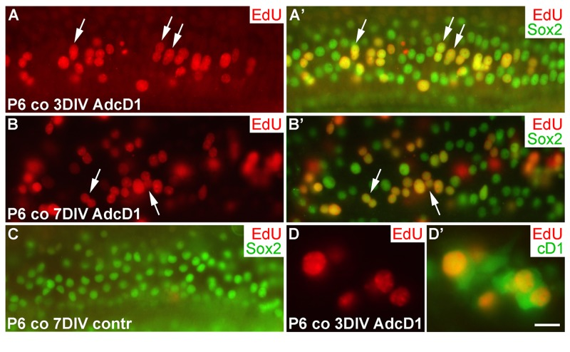 Proliferative response of juvenile cochlear supporting cells to cyclin D1 overexpression. (A,A') The AdcD1-infected cochlea shows EdU+/Sox2+ Deiters' cells at 3 DIV. (B,B') At 7 DIV, despite cell cycle re-entry of Deiters' cells, this cell population lacks clear signs of supernumerary cells. (C) A non-infected cochlear explant is devoid of proliferating SCs. (D,D') An AdcD1-infected P6 cochlea shows EdU+/cD1+ SCs. Abbreviations: co, cochlea; AdcD1, adenovirus encoding cyclin D1. Scale bar, shown in D': A-C, 20 µm; D,D', 10 µm.
