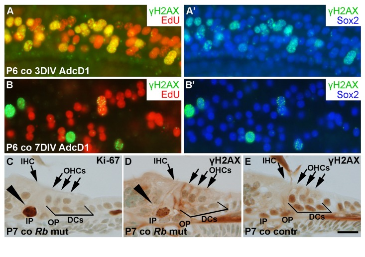 Unscheduled proliferation is a specific trigger for the DNA damage response in auditory SCs in vitro and in vivo. (A,A') AdcD1-infected P6 cochleas pulsed with EdU (for 24 h between days 2 and 3) and maintained for 3 DIV show accumulation of γH2AX foci in cell cycle reactivated EdU+ Deiters' cells. (B,B') Most EdU+ Deiters' cells show γH2AX downregulation by 7 DIV. (C-E) Cross-sections through the cochlea of a RbloxP/loxP;Fgfr3-iCre-ERT2 mutant mouse at P7 show Ki-67-stained pillar cells (arrowhead in C). γH2AX foci can be seen in pillar cells (arrowhead in D) of mutant, but not control mice. Abbreviations: AdcD1, adenovirus encoding cyclin D1; γH2AX, Ser 139 phosphorylated histone H2AX; co, cochlea; DCs, Deiters' cells; IHC, inner hair cell; OHCs, outer hair cells; IP, inner pillar cell; OP, outer pillar cell; Rb mut, RbloxP/loxP;Fgfr3-iCre-ERT2. Scale bar, shown in E: A-E, 20 µm.