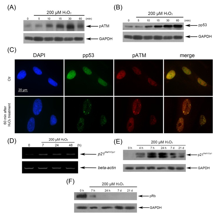 H2O2-induced activation of the p53/p21/pRb pathway in hMESCs