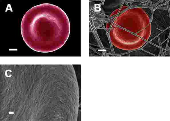 Representative erythrocytes of healthy individuals prepared from whole blood smears. Serum ferritin = 48 ng.mL−1 (A) Erythrocyte prepared from whole blood without thrombin; scale = 1μm; (B) Erythrocyte prepared from whole blood with added thrombin to create extensive fibrin fibre network around erythrocytes; scale = 1μm; (C) High machine magnification of 150,000x showing erythrocyte membrane, scale bar = 100 nm.