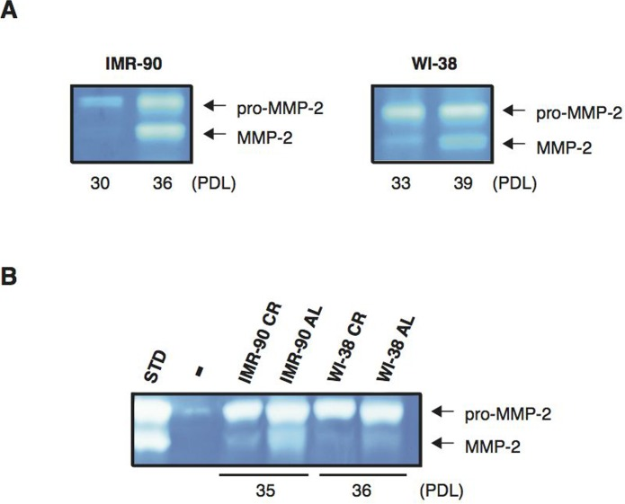 CR treatment reduces MMP-2 activity in normal human diploid fibroblasts