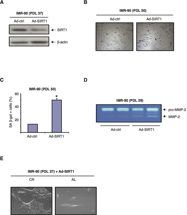 SIRT1 siRNA-mediated downregulation exacerbates the development of senescence in normal human diploid fibroblasts