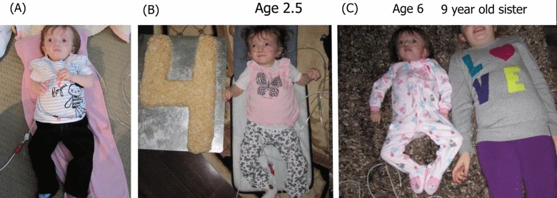 Photographs of one of the cases in the current study at various ages