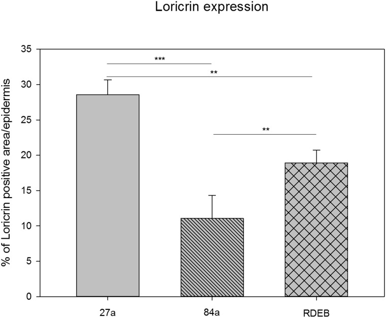 Quantification of loricrin immunoreactivity by using a particle size measurement tool revealed the highest loricrin expression in the epidermis of the middle aged proband (27a). A significantly reduced loricrin expression was detected in the aged proband (84a) as well as in the RDEB patient's epidermis.