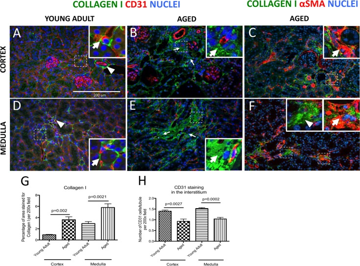Increase in interstitial fibrosis and reduction of microvascular density in aged mice kidneys