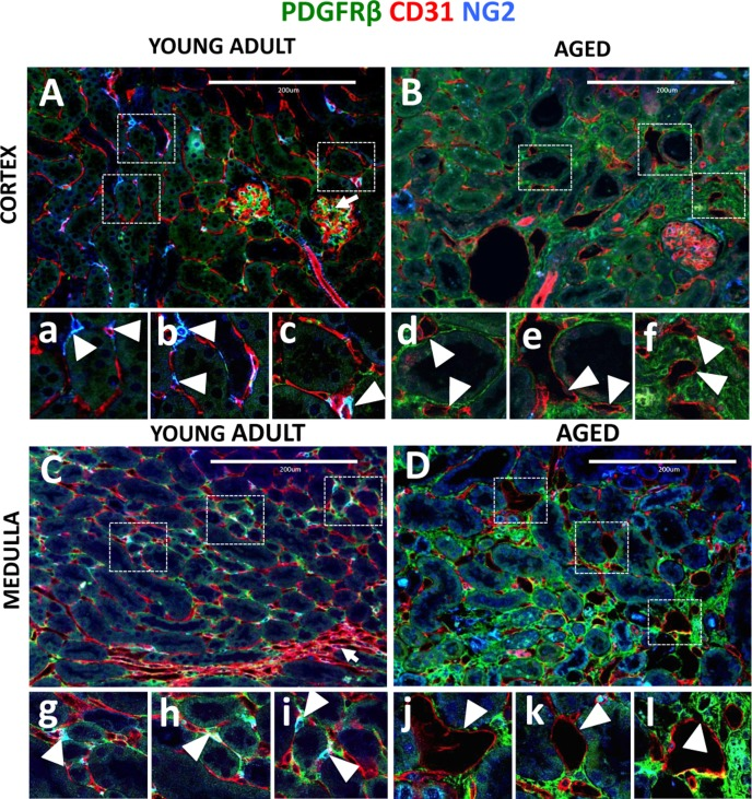 Capillary dilation in aged mice was associated with reduced pericyte coverage
