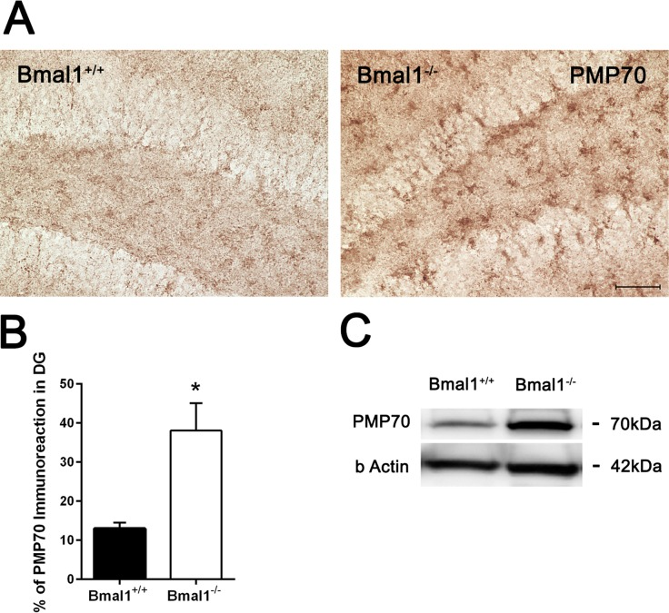 PMP70 expression was increased in Bmal1‐/‐ mice