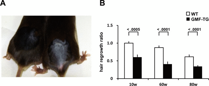 Hair regrowth phenotypes in WT and GMF-TG mice