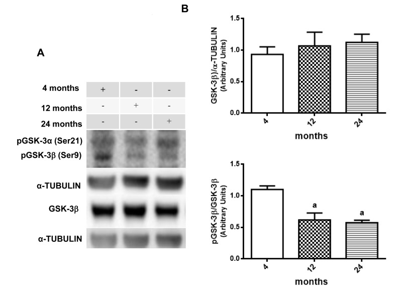 Changes in the pGSK-3β/GSK-3β ratio in hippocampus of 4-, 12- and 24-month-old rats