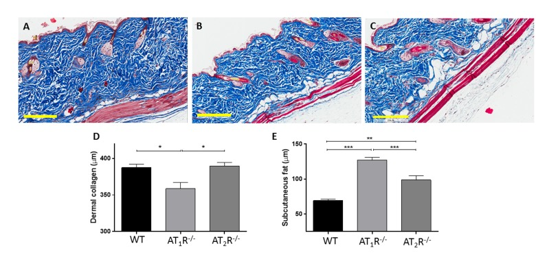 Masson's trichrome staining of skin sections from WT (A), AT1R−/− (B) and AT2R−/− (C) mouse cohorts shows an expanded zone of subcutaneous fat in the angiotensin knockout mice. Quantification of the thickness of the zones of dermal collagen and subcutaneous fat in wild-type and mutant mice is shown. Scale bar 200 μm. *p